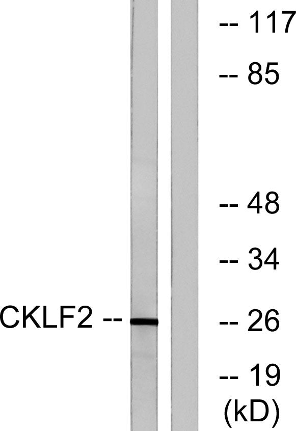 CMTM2 Rabbit Polyclonal Antibody