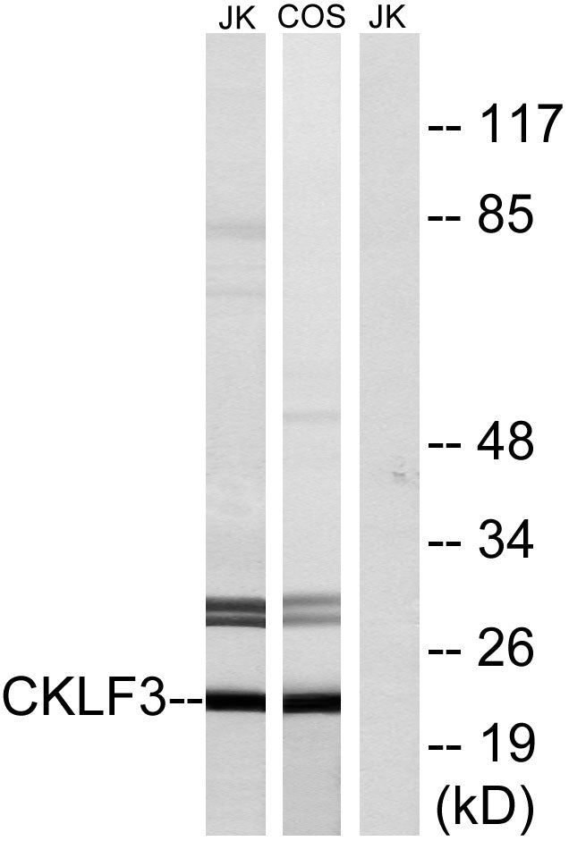 CMTM3 Rabbit Polyclonal Antibody