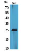 CMTM5 Rabbit Polyclonal Antibody