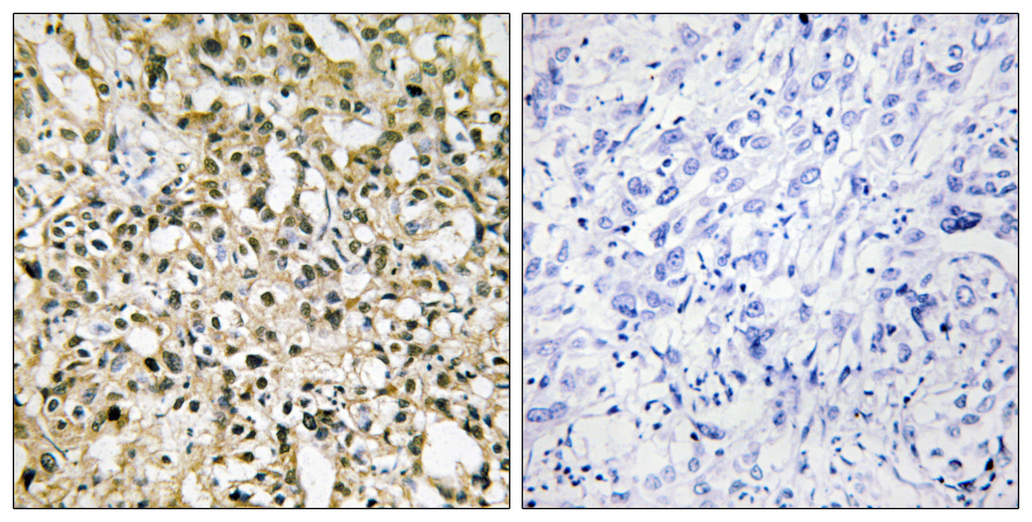 c-Myc Rabbit Polyclonal Antibody