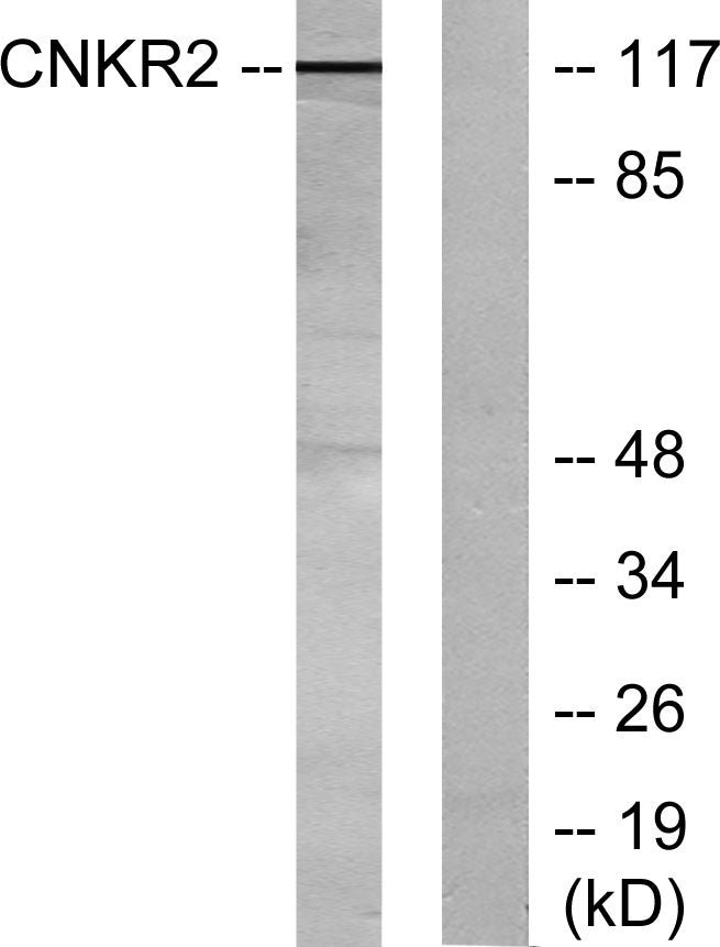 CNK2 Rabbit Polyclonal Antibody