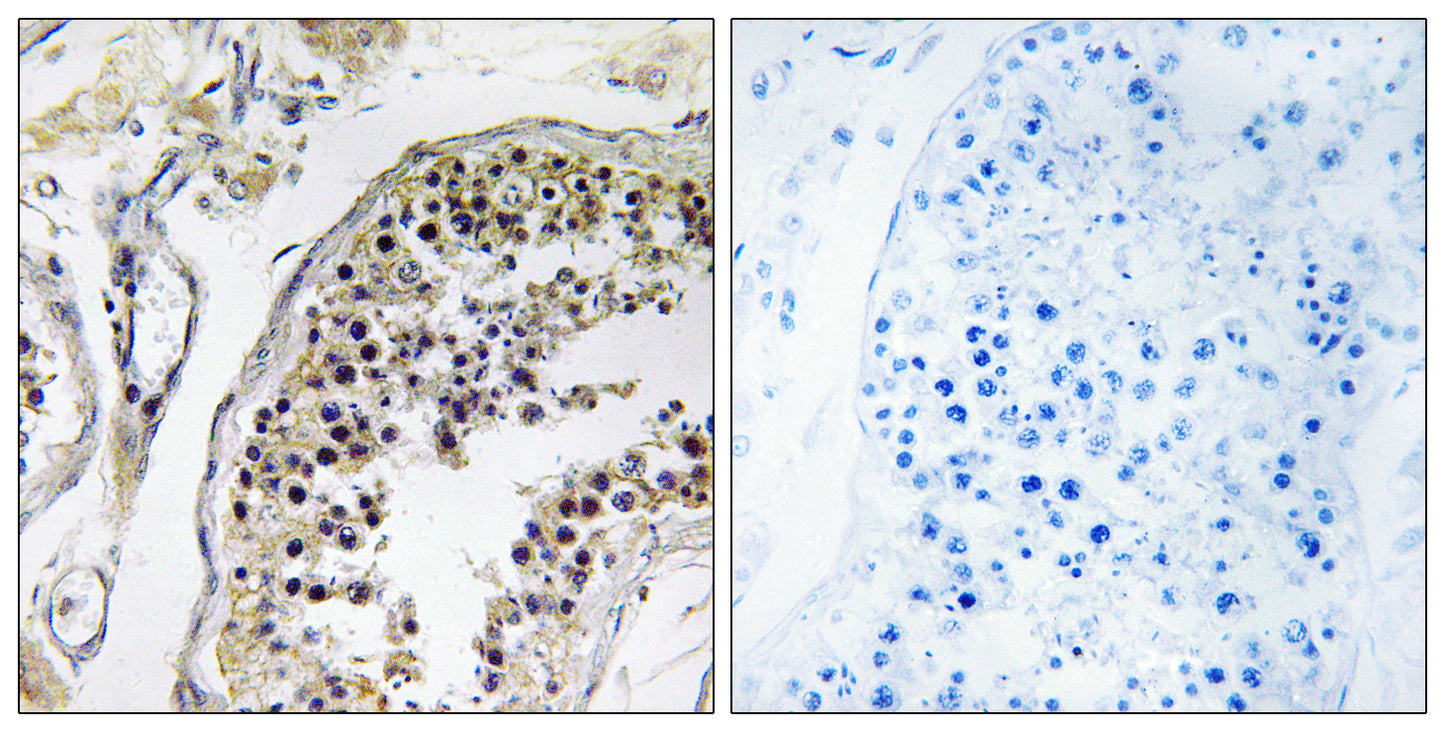 CNOT4 Rabbit Polyclonal Antibody