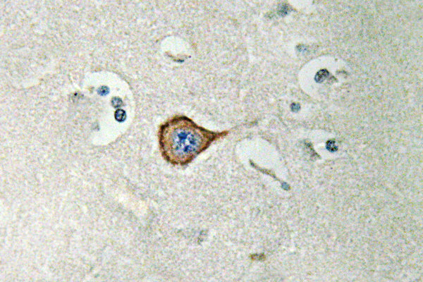 CNPase Rabbit Polyclonal Antibody