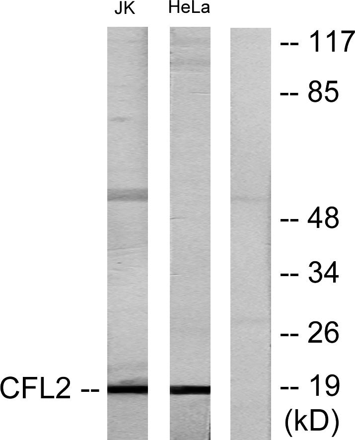 Cofilin Rabbit Polyclonal Antibody