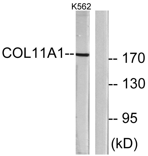 COL11A1 Rabbit Polyclonal Antibody