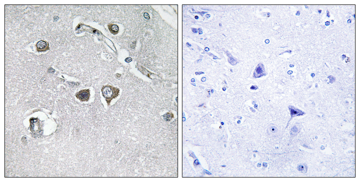 COL11A2 Rabbit Polyclonal Antibody
