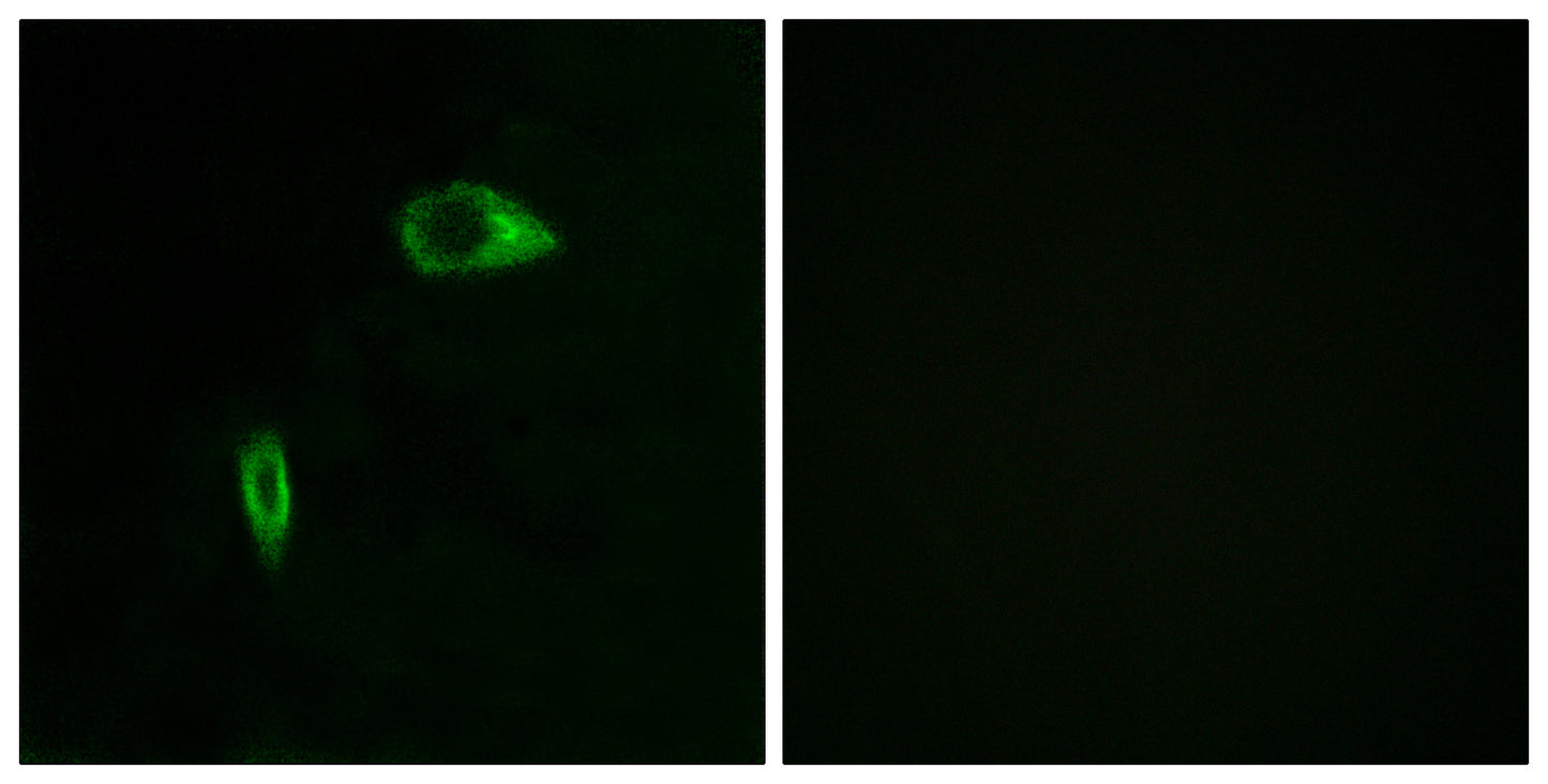 COL14A1 Rabbit Polyclonal Antibody
