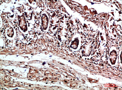 COL17A1 Rabbit Polyclonal Antibody