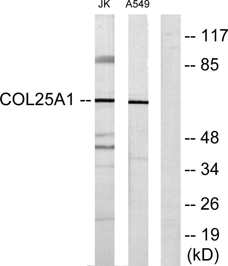 COL25A1 Rabbit Polyclonal Antibody