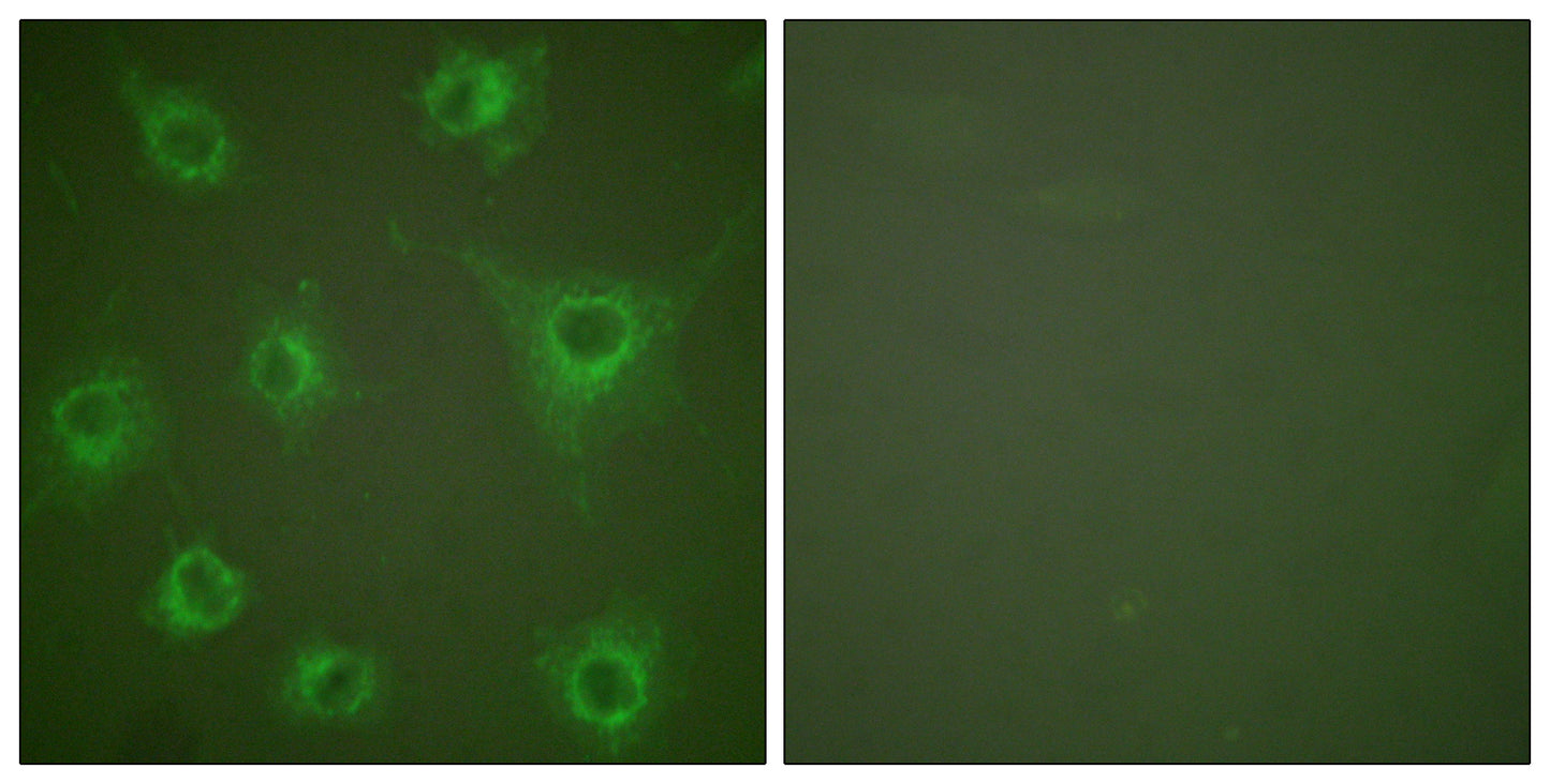 COL2A1 Rabbit Polyclonal Antibody