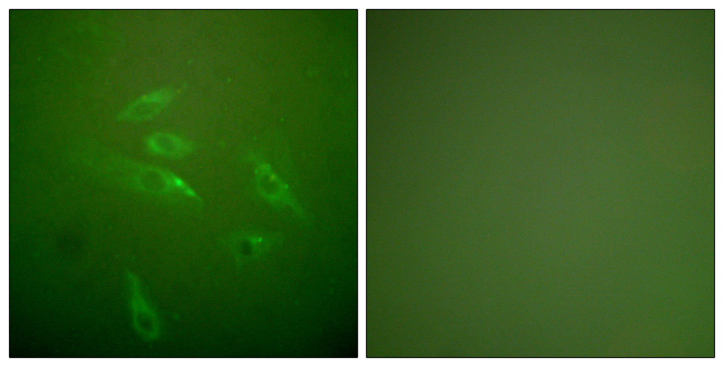 COL3A1 Rabbit Polyclonal Antibody