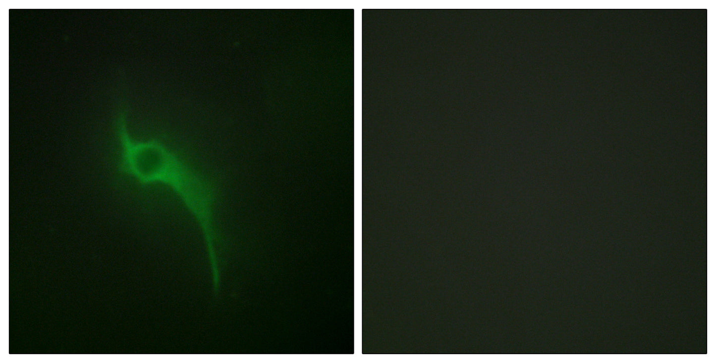 COL5A1 Rabbit Polyclonal Antibody