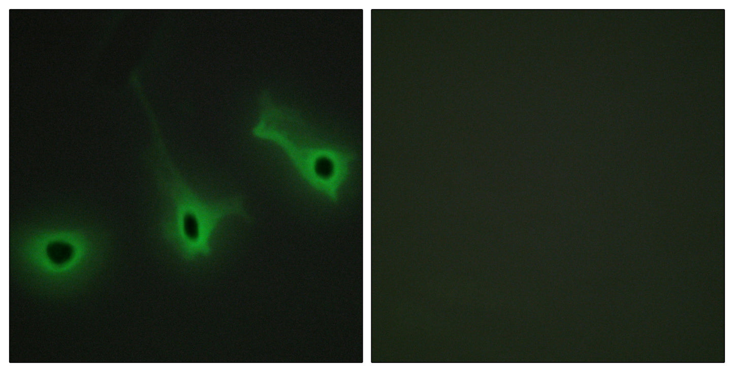COL5A3 Rabbit Polyclonal Antibody