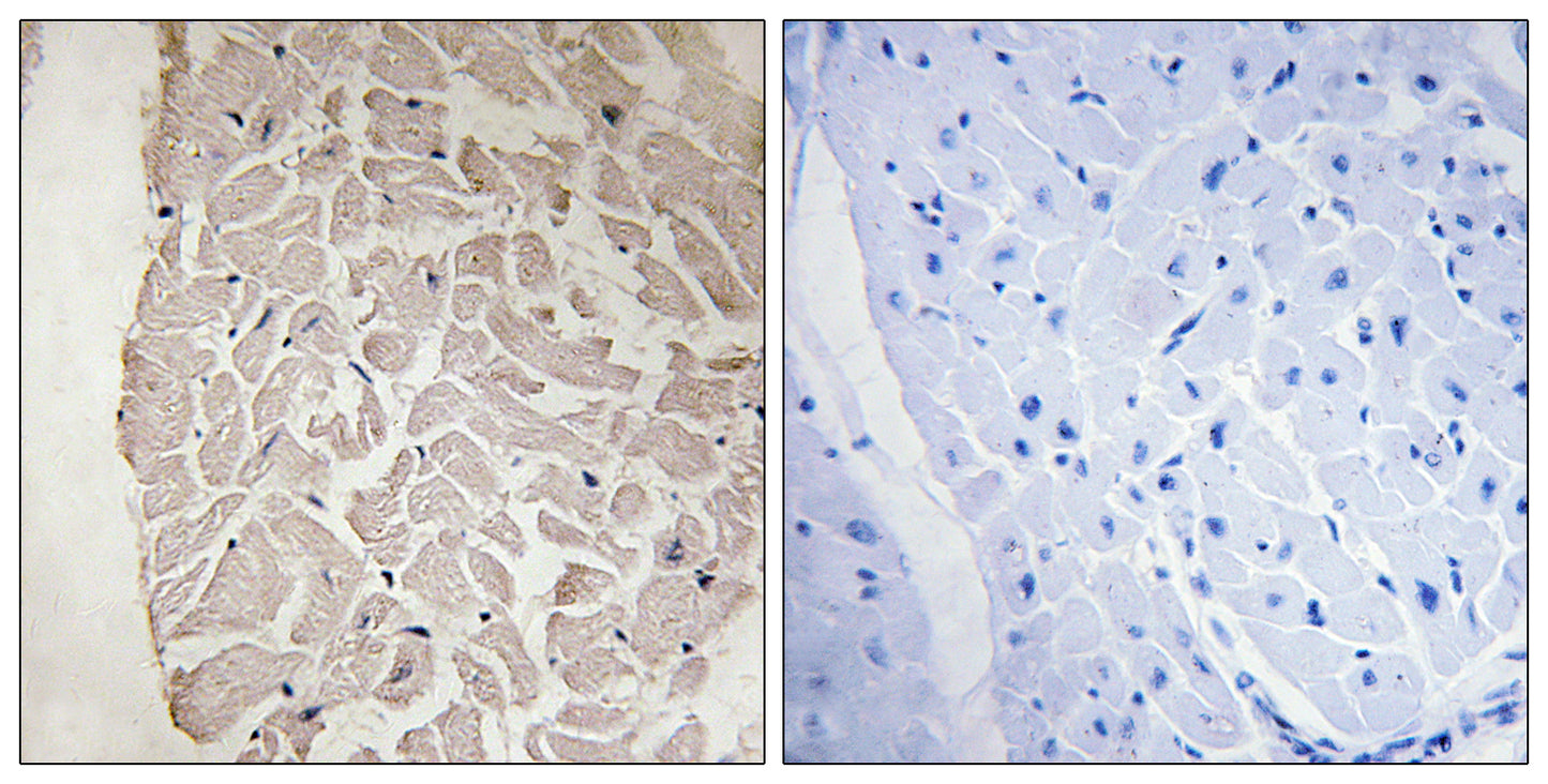 COL6A1 Rabbit Polyclonal Antibody