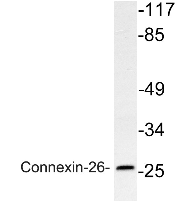 Connexin-26 Rabbit Polyclonal Antibody