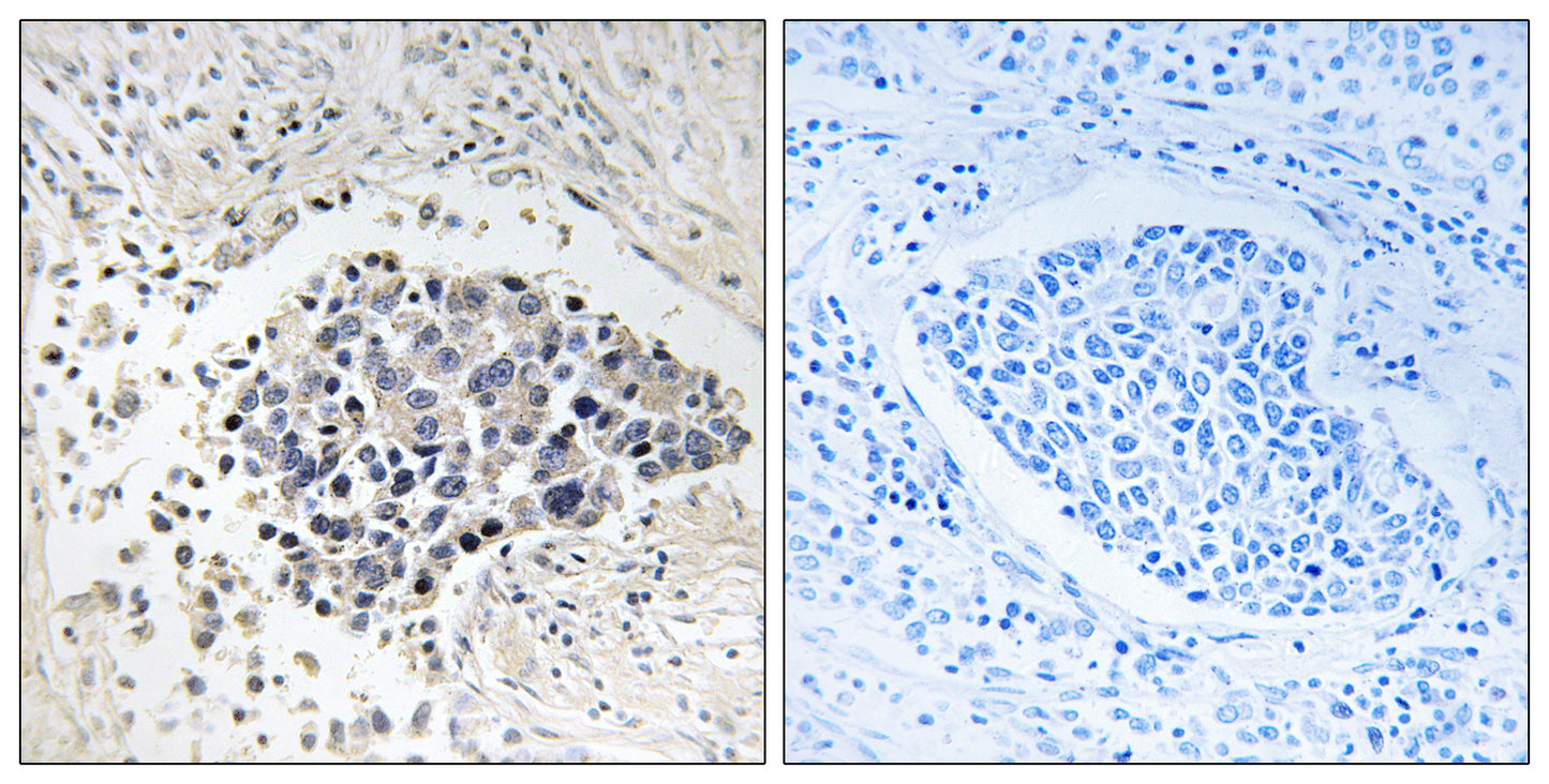 Copine 8 Rabbit Polyclonal Antibody