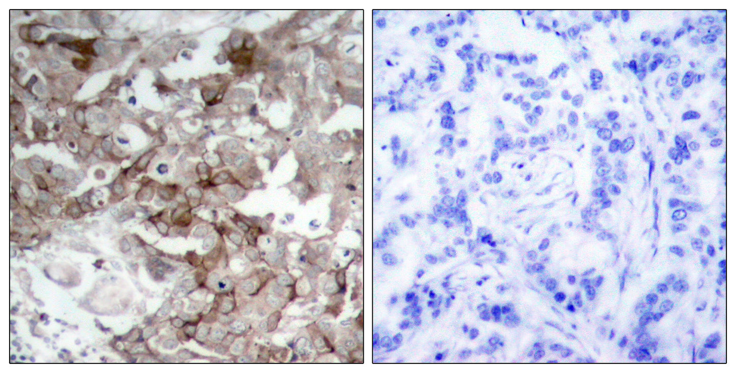 Cortactin Rabbit Polyclonal Antibody