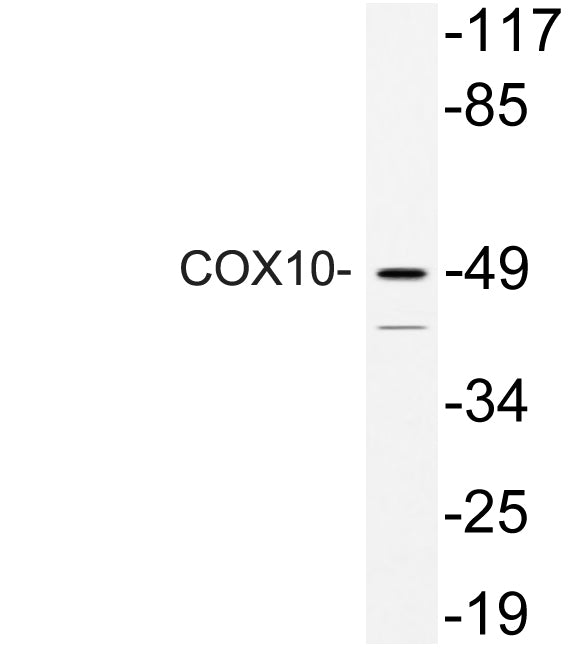COX10 Rabbit Polyclonal Antibody