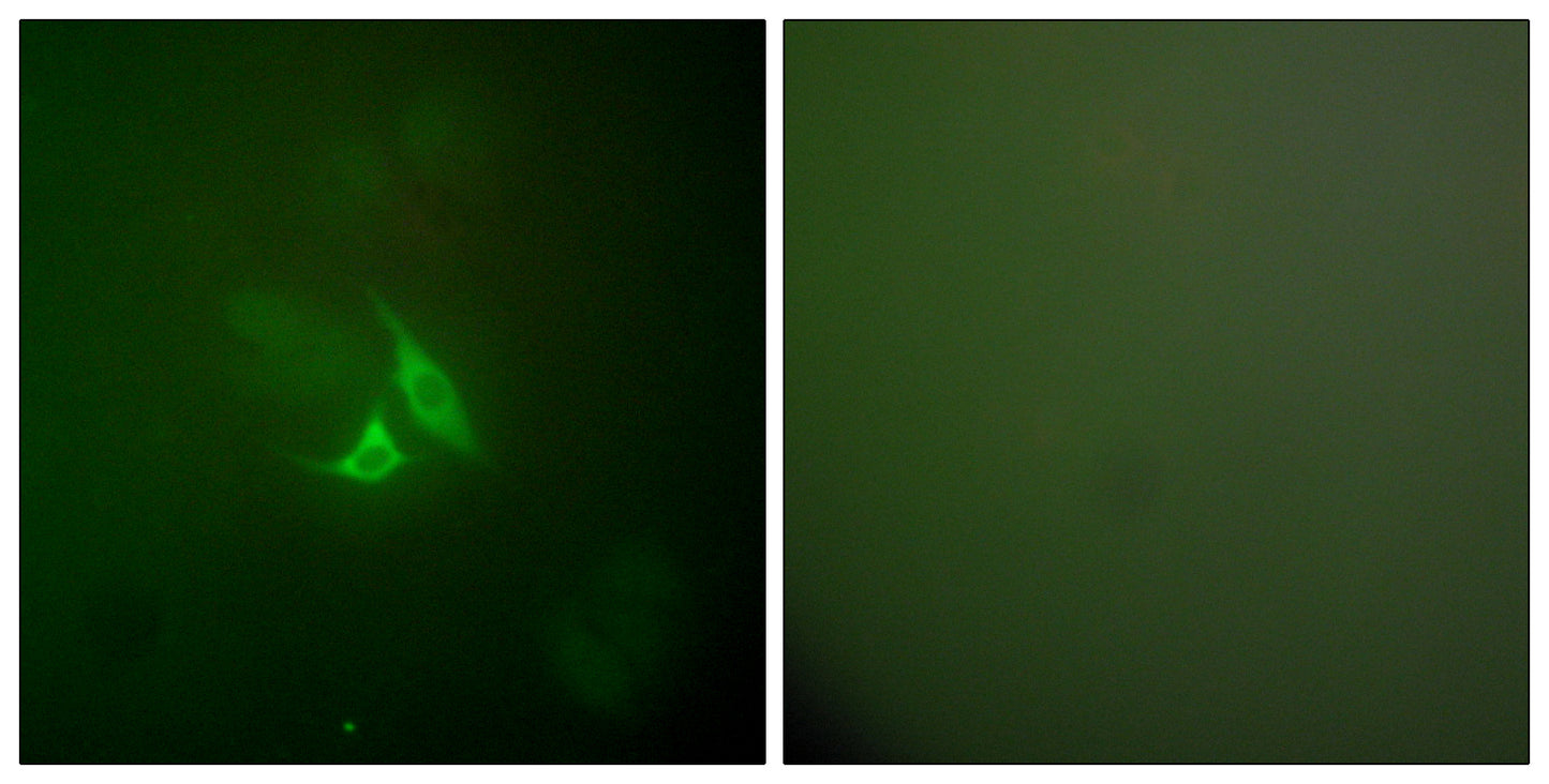 COX2 Rabbit Polyclonal Antibody