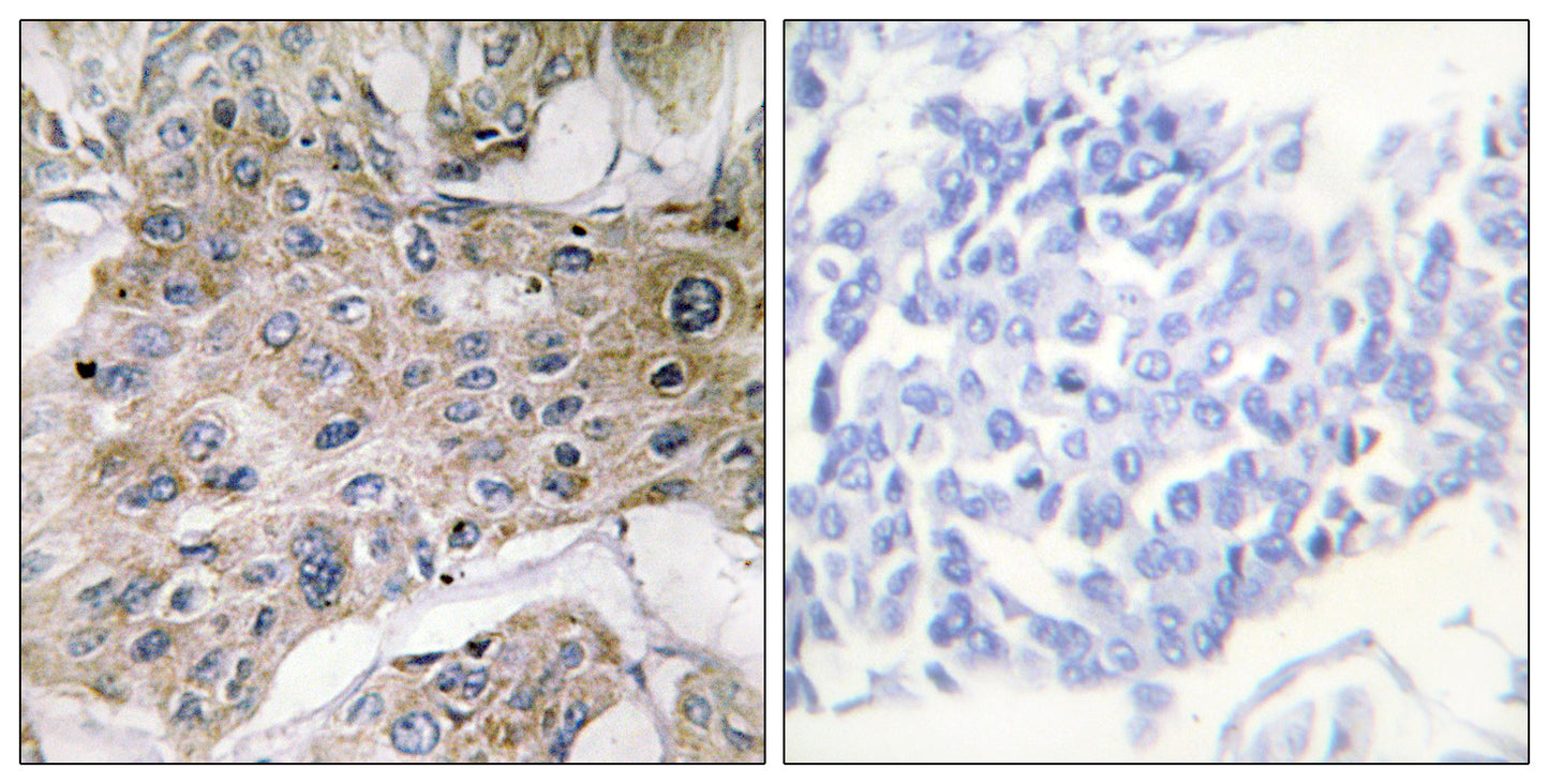 COX7a2/3 Rabbit Polyclonal Antibody