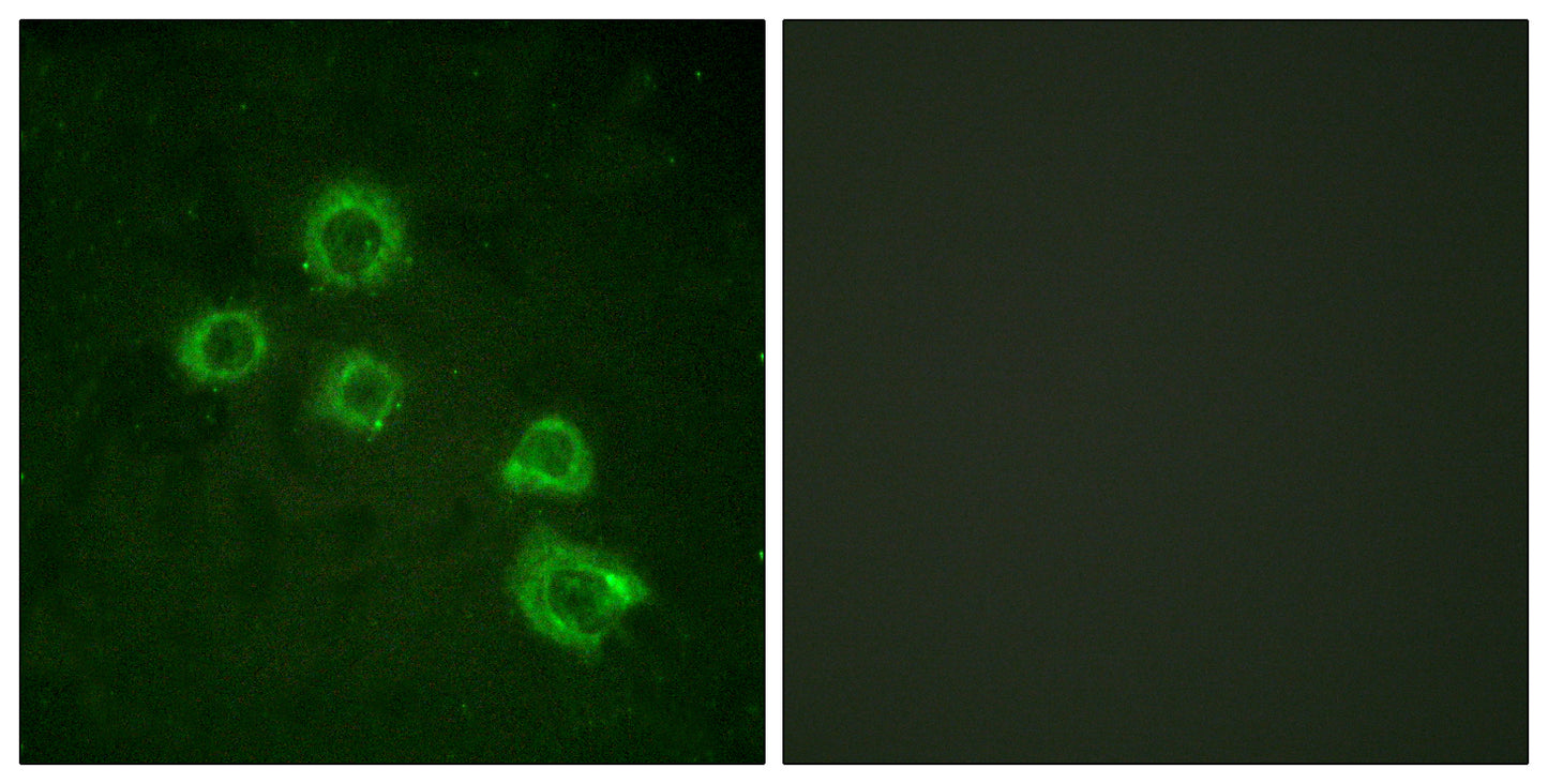cPLA2 Rabbit Polyclonal Antibody