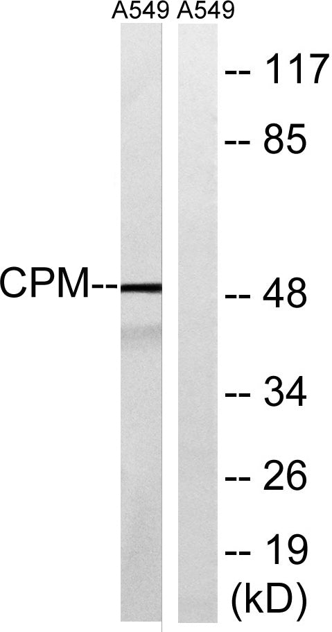 CPM Rabbit Polyclonal Antibody
