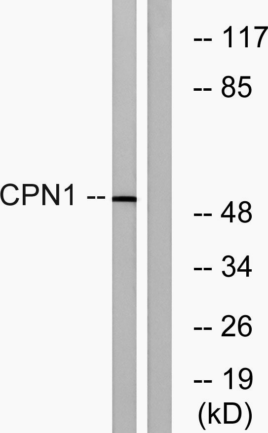 CPN cat Rabbit Polyclonal Antibody