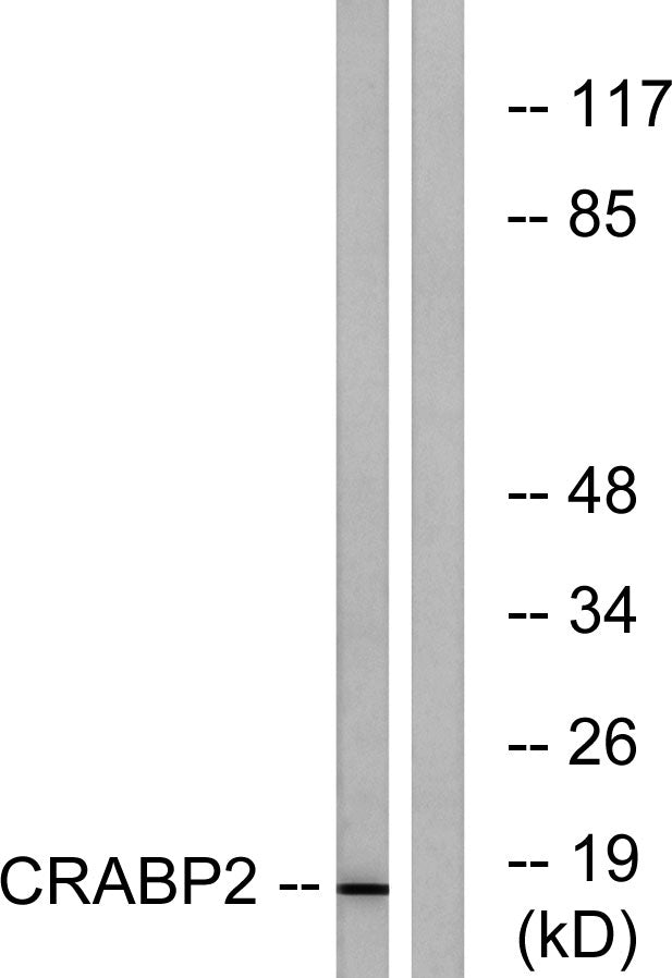 CRABP-II Rabbit Polyclonal Antibody