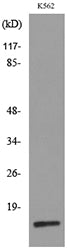 CRBP II Rabbit Polyclonal Antibody