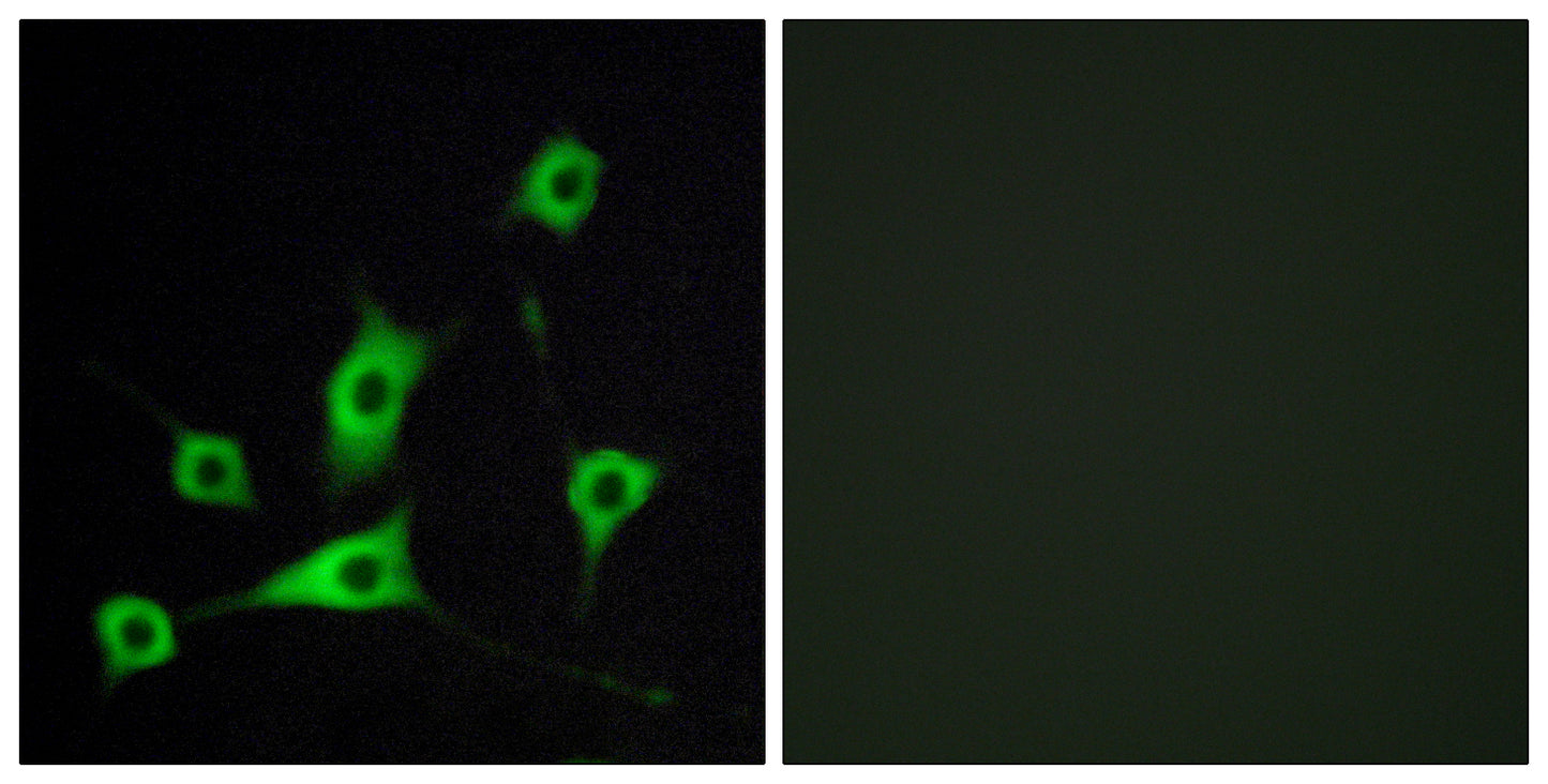 CRBP-III Rabbit Polyclonal Antibody