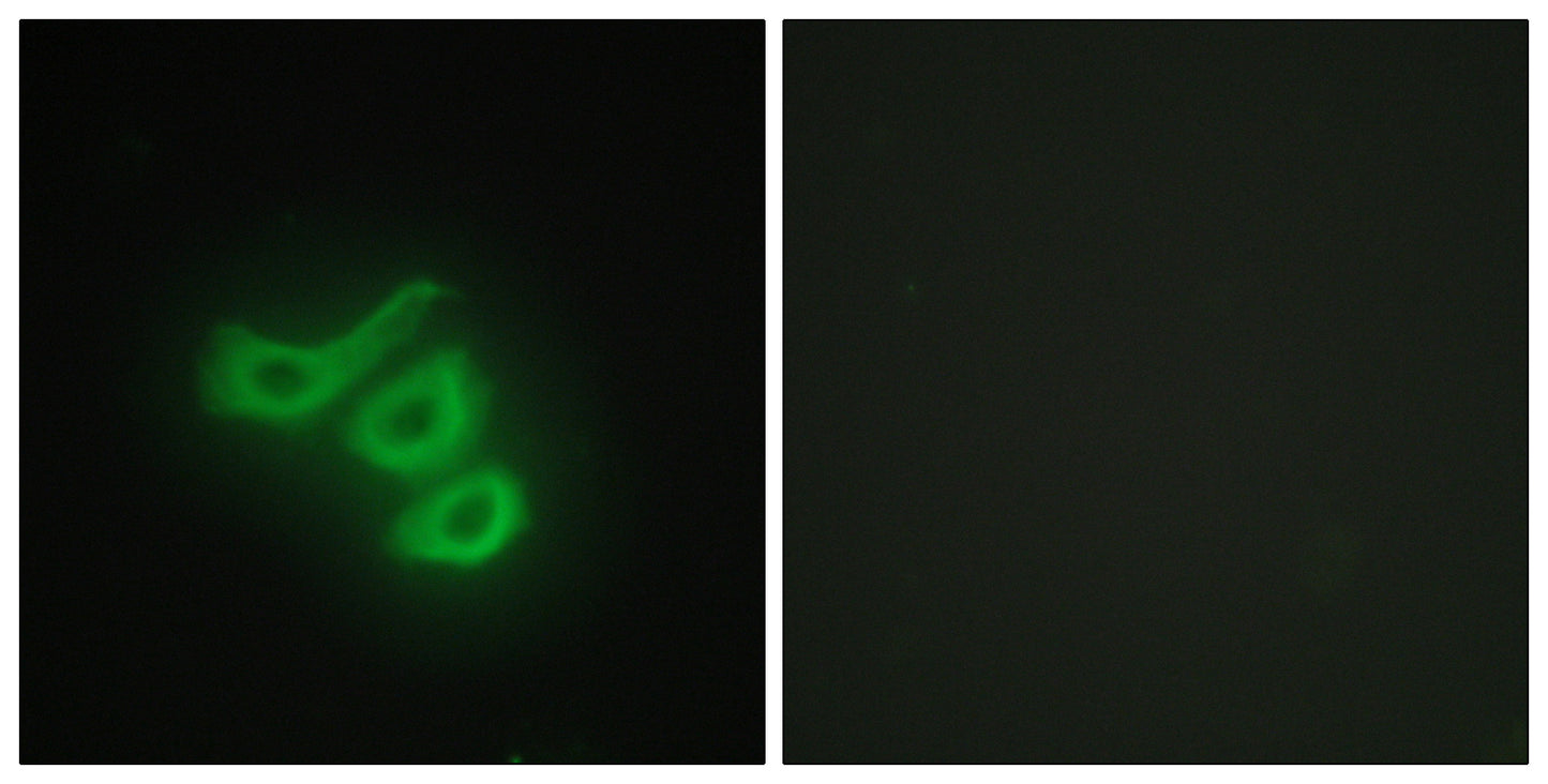 Creatine Kinase M Rabbit Polyclonal Antibody