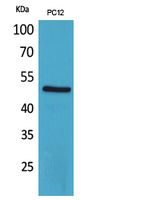 CRF-RI Rabbit Polyclonal Antibody