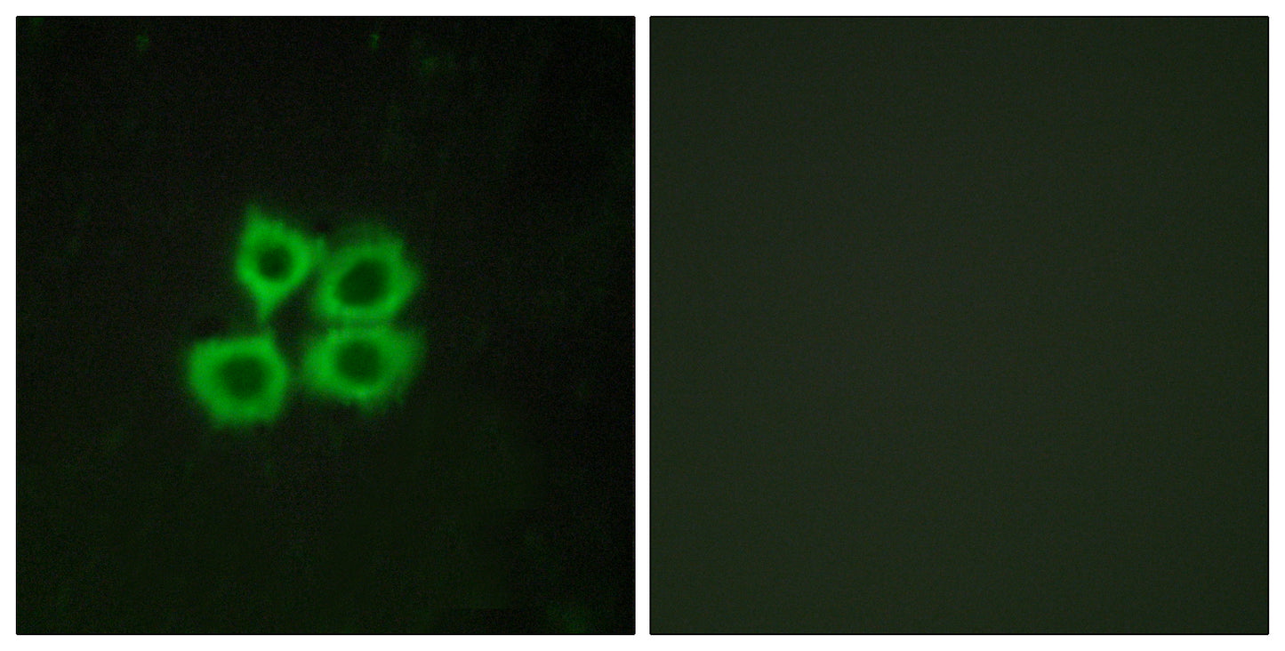 CRF-RII Rabbit Polyclonal Antibody