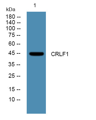CRLF1 Rabbit Polyclonal Antibody