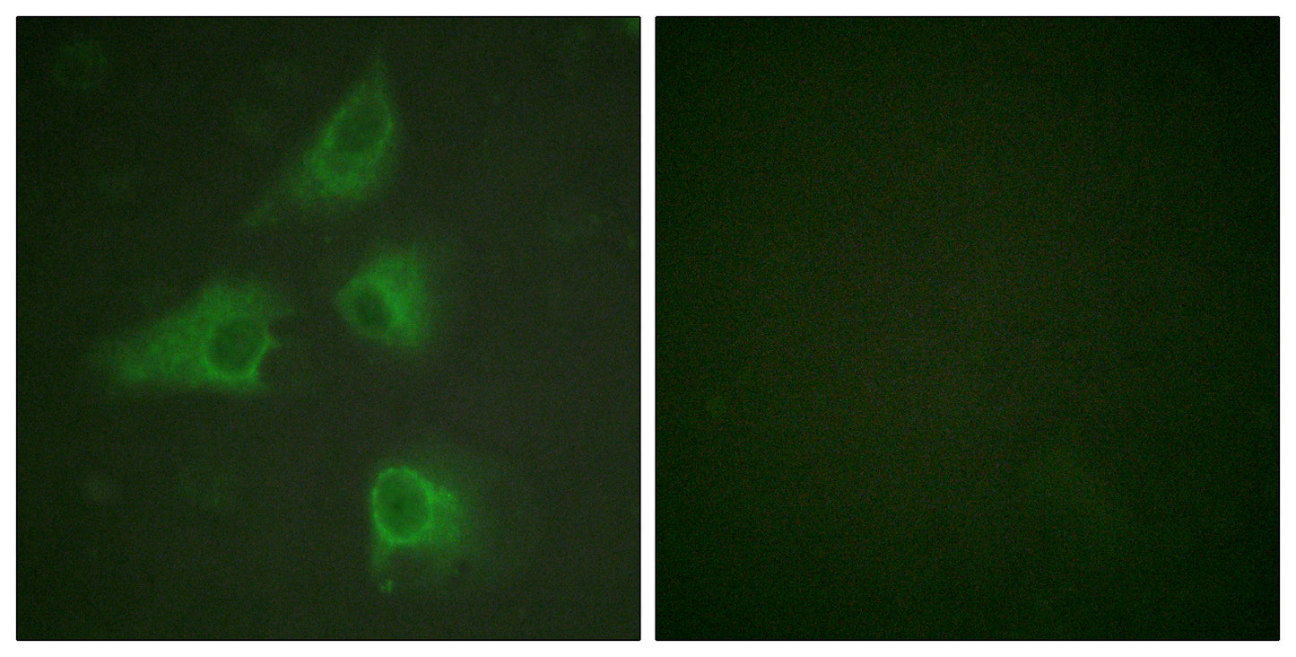 CRMP-2 Rabbit Polyclonal Antibody