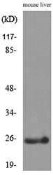 CRP Rabbit Polyclonal Antibody