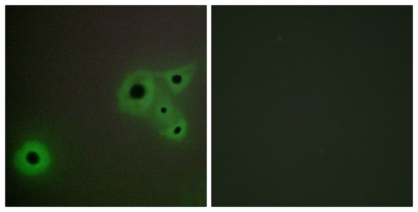 CRSP130 Rabbit Polyclonal Antibody