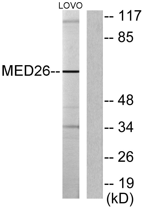 CRSP70 Rabbit Polyclonal Antibody
