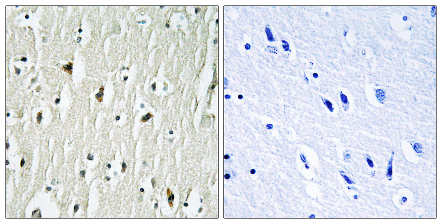 Csk Rabbit Polyclonal Antibody