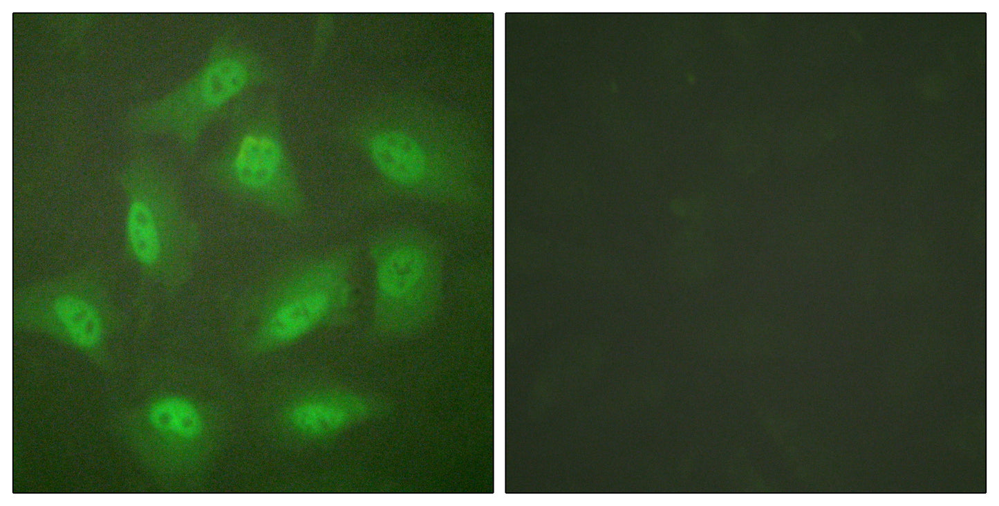 CSN3 Rabbit Polyclonal Antibody