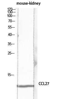 CTACK Rabbit Polyclonal Antibody