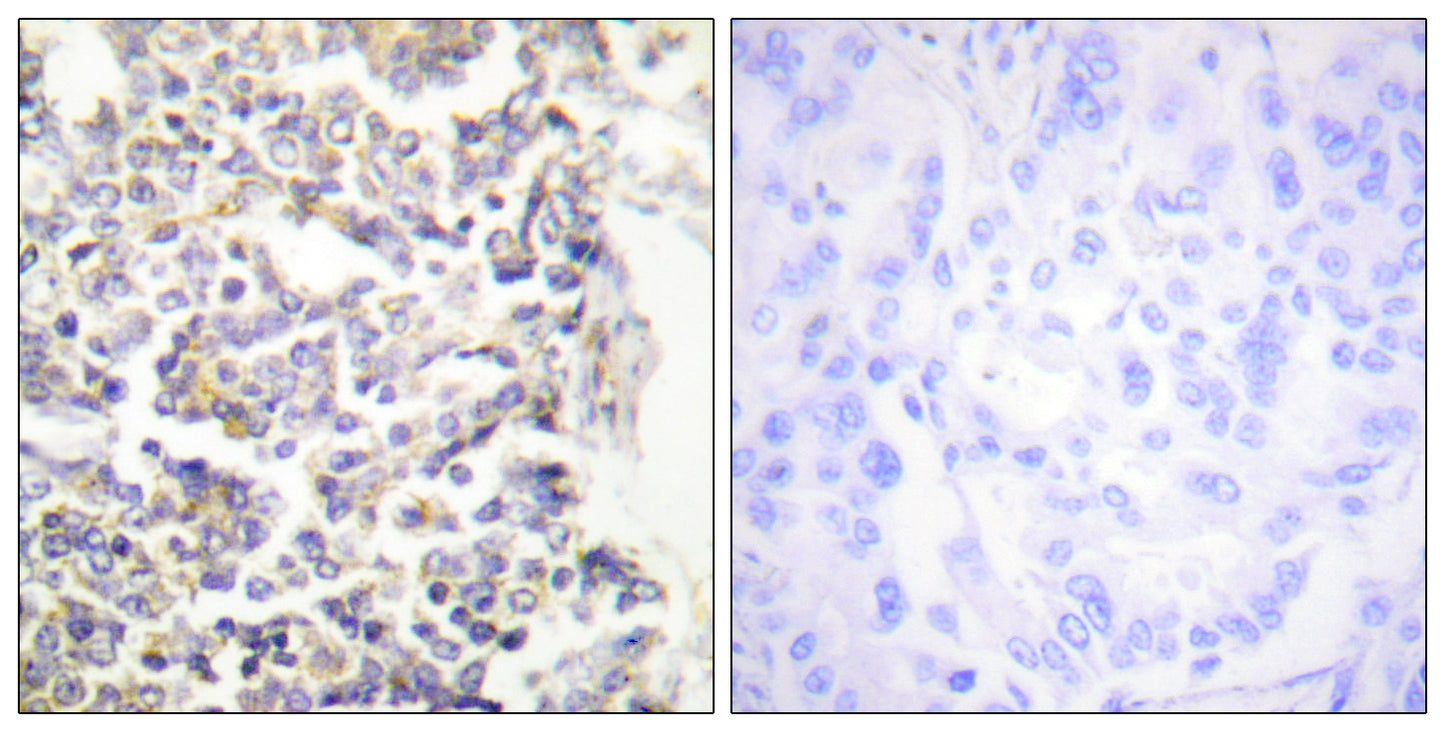 C-TAK1 Rabbit Polyclonal Antibody