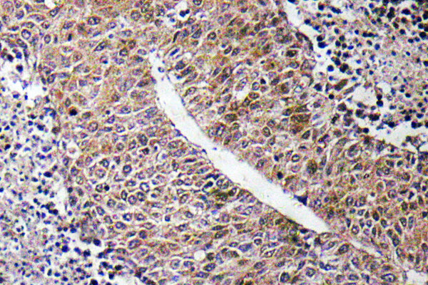 CTPS Rabbit Polyclonal Antibody