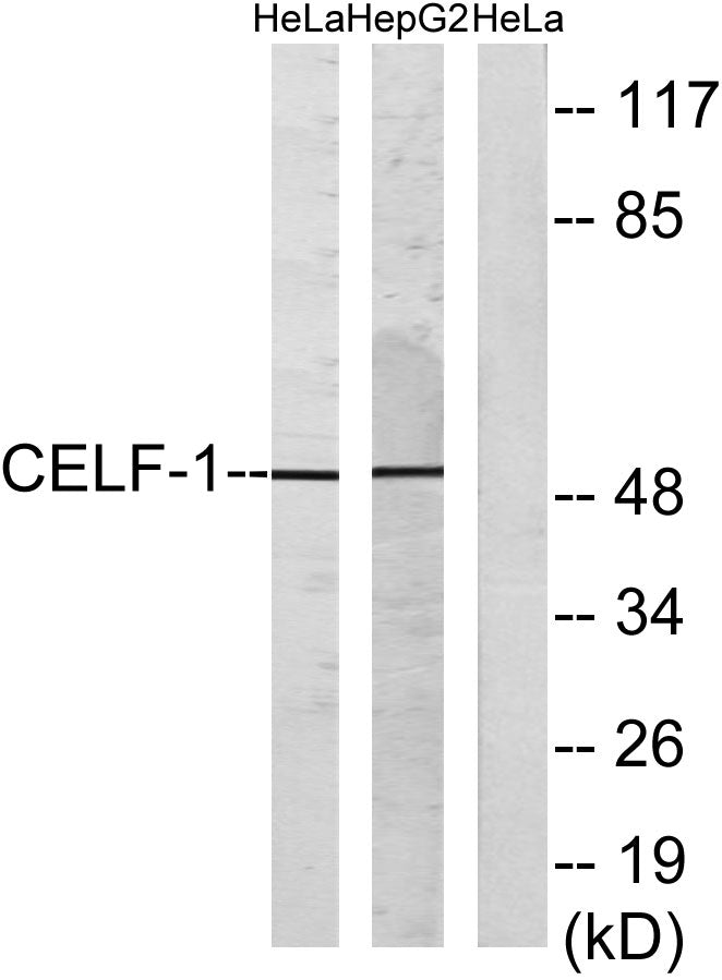 CUG-BP1 Rabbit Polyclonal Antibody