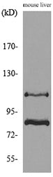 CUL-4B Rabbit Polyclonal Antibody