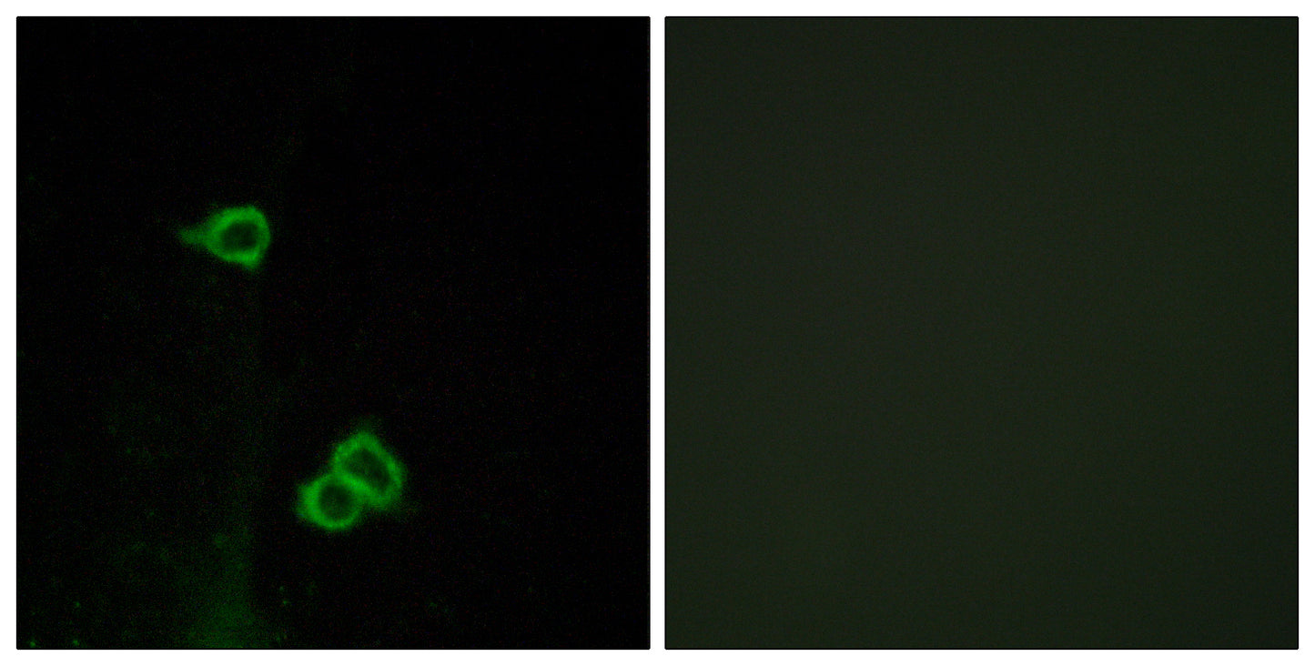 CXCR-7 Rabbit Polyclonal Antibody