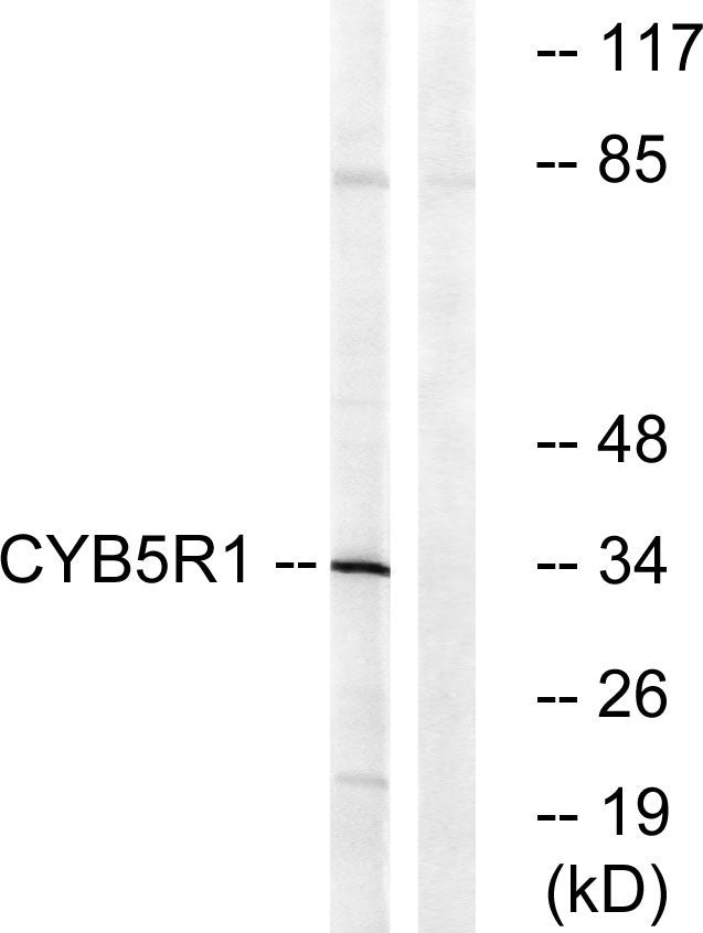 CYB5R1 Rabbit Polyclonal Antibody