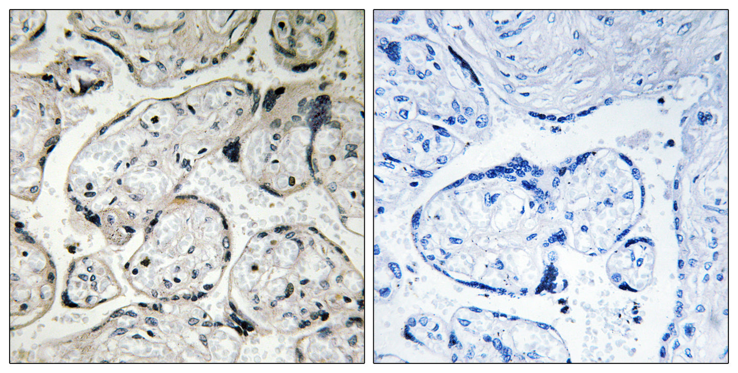 CYB5R3 Rabbit Polyclonal Antibody