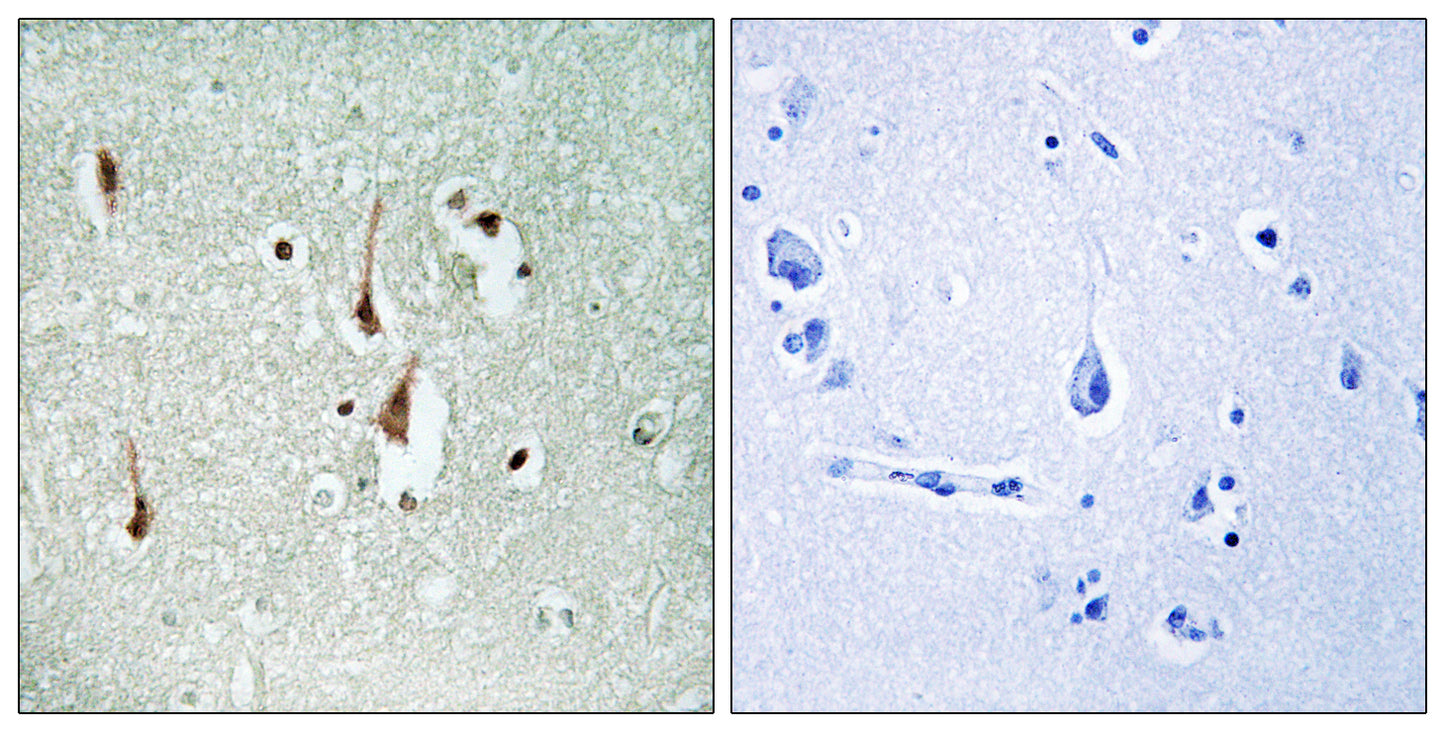 Cyclin D1 Rabbit Polyclonal Antibody