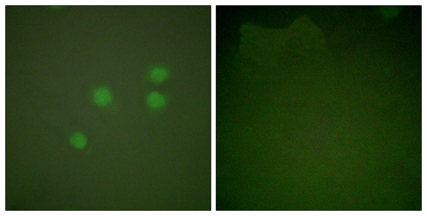 Cyclin E1 Rabbit Polyclonal Antibody